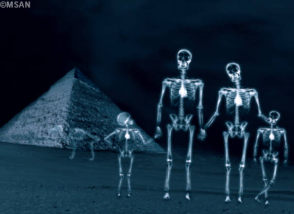 Comment se débarrasser de ses vieilles radiographies argentiques ?
