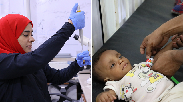Les équipes de MSF sont présentes à travers le monde et notamment au Yémen.