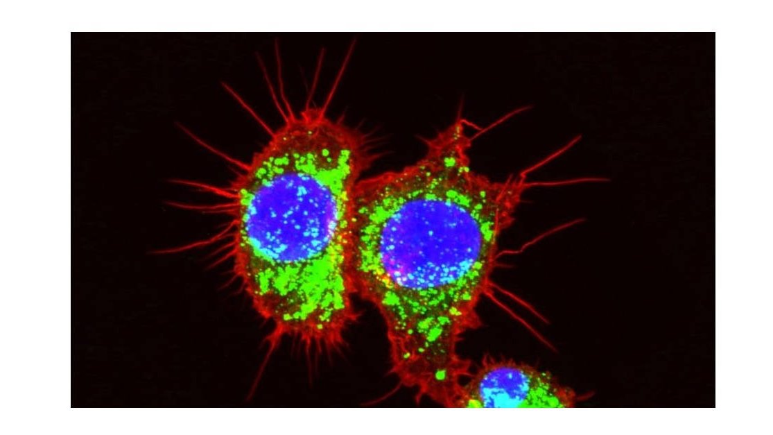 Recherche sur le cancer : Comment les cellules leucémiques arrivent à manipuler des cellules saines environnantes à leur avantage
