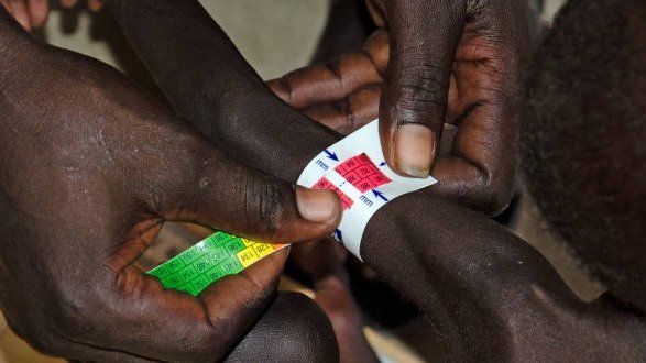 Soudan du Sud : le taux de malnutrition infantile explose