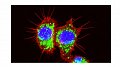 Recherche sur le cancer : Comment les cellules leucémiques arrivent à manipuler des cellules saines environnantes à leur avantage
