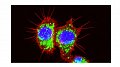 Recherche sur le cancer : Comment les cellules leucémiques arrivent à manipuler des cellules saines environnantes à leur avantage
